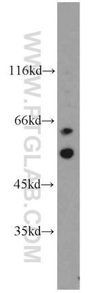 SRC Antibody in Western Blot (WB)