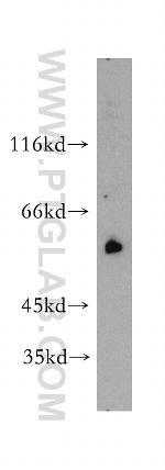 SRC Antibody in Western Blot (WB)