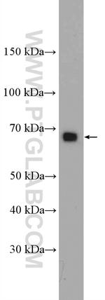 RANGAP1 Antibody in Western Blot (WB)