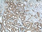STK38 Antibody in Immunohistochemistry (Paraffin) (IHC (P))
