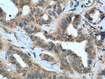 STK38 Antibody in Immunohistochemistry (Paraffin) (IHC (P))