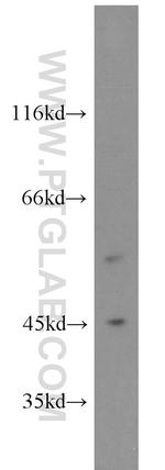 STK38 Antibody in Western Blot (WB)
