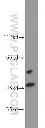 STK38 Antibody in Western Blot (WB)