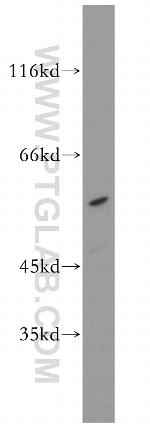 STK38 Antibody in Western Blot (WB)