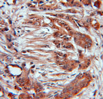 CUL3 Antibody in Immunohistochemistry (Paraffin) (IHC (P))