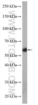 ACVR1 Antibody in Western Blot (WB)