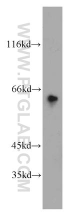 ETFDH Antibody in Western Blot (WB)