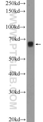 ETFDH Antibody in Western Blot (WB)