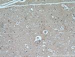 CYLD Antibody in Immunohistochemistry (Paraffin) (IHC (P))
