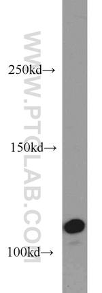 CYLD Antibody in Western Blot (WB)