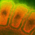 Hsp25/Hsp27 Antibody in Immunohistochemistry (Paraffin) (IHC (P))