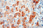 ACAA2 Antibody in Immunohistochemistry (Paraffin) (IHC (P))