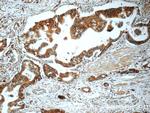 TAP1 Antibody in Immunohistochemistry (Paraffin) (IHC (P))
