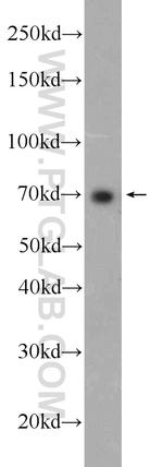 TAP1 Antibody in Western Blot (WB)