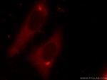 DDX3 Antibody in Immunocytochemistry (ICC/IF)