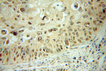 DDX3 Antibody in Immunohistochemistry (Paraffin) (IHC (P))