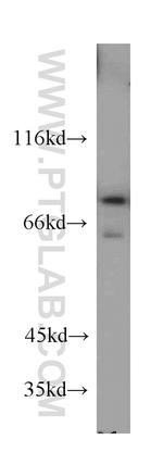 DDX3 Antibody in Western Blot (WB)
