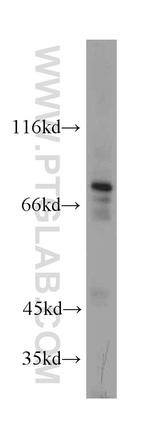 DDX3 Antibody in Western Blot (WB)