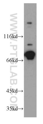 DDX3 Antibody in Western Blot (WB)