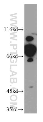 DDX3 Antibody in Western Blot (WB)