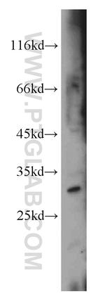 CTDSP2 Antibody in Western Blot (WB)