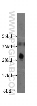 CTDSP2 Antibody in Western Blot (WB)
