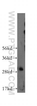 CTDSP2 Antibody in Western Blot (WB)
