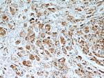 TXNRD1 Antibody in Immunohistochemistry (Paraffin) (IHC (P))