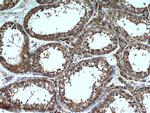 Tim23 Antibody in Immunohistochemistry (Paraffin) (IHC (P))