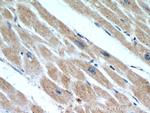 Tim23 Antibody in Immunohistochemistry (Paraffin) (IHC (P))
