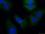 TESC Antibody in Immunocytochemistry (ICC/IF)