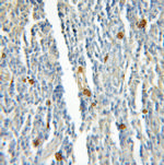 Rad51D Antibody in Immunohistochemistry (Paraffin) (IHC (P))