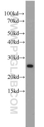 Rad51D Antibody in Western Blot (WB)