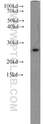 Rad51D Antibody in Western Blot (WB)