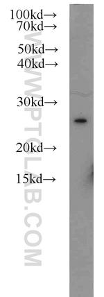 Rad51D Antibody in Western Blot (WB)
