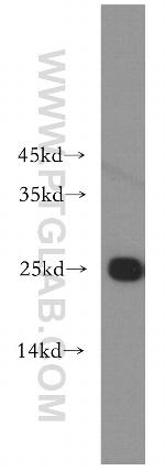 Rad51D Antibody in Western Blot (WB)