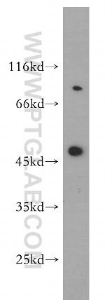 SH3BP5 Antibody in Western Blot (WB)