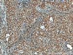 MYH9 Antibody in Immunohistochemistry (Paraffin) (IHC (P))