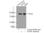 MYH9 Antibody in Immunoprecipitation (IP)