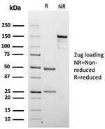 Chromogranin A/CHGA (Neuroendocrine Marker) Antibody in SDS-PAGE (SDS-PAGE)