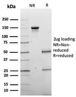 Chromogranin A/CHGA (Neuroendocrine Marker) Antibody in SDS-PAGE (SDS-PAGE)