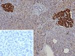 Chromogranin A/CHGA (Neuroendocrine Marker) Antibody in Immunohistochemistry (Paraffin) (IHC (P))