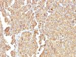 Chromogranin A/CHGA (Neuroendocrine Marker) Antibody in Immunohistochemistry (Paraffin) (IHC (P))