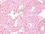 Chromogranin A/CHGA (Neuroendocrine Marker) Monoclonal Antibody (LK2H10, PHE5)