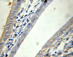 PTPN4 Antibody in Immunohistochemistry (Paraffin) (IHC (P))