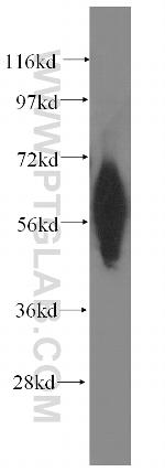PTPN4 Antibody in Western Blot (WB)