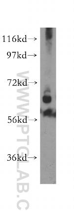 PTPN4 Antibody in Western Blot (WB)