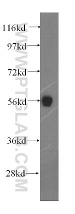 PTPN4 Antibody in Western Blot (WB)