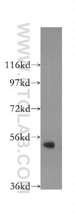 PTPN4 Antibody in Western Blot (WB)