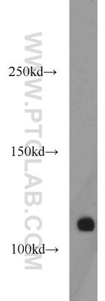 CNOT3 Antibody in Western Blot (WB)